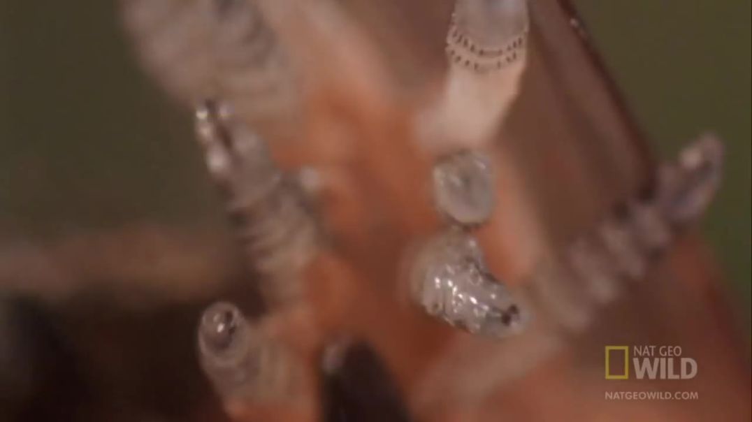 Medical Team Removes Larva from Girl's Scalp | World's Weirdest!